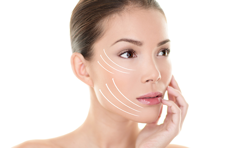 tratamiento hilos tensores barcelona